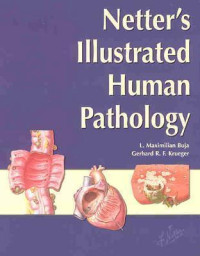 Image of Netter's Illustrated Human Pathology